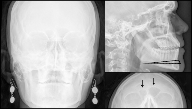 Image-5-X-Rays