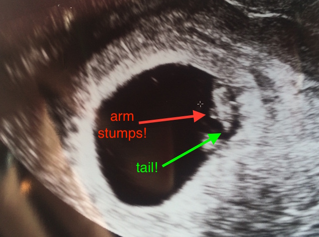 Seven week viability ultrasound confirmed I'm harboring a little creature!