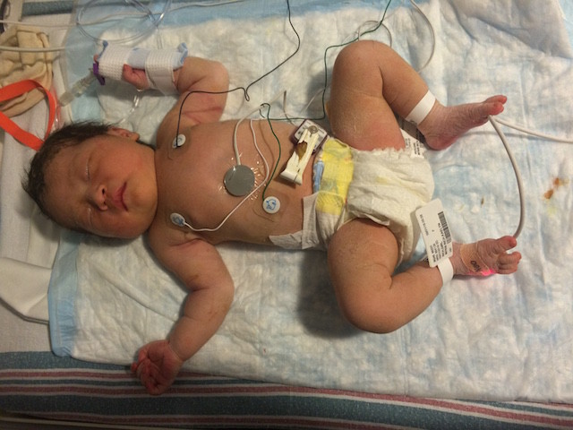 Remi, a few hours after birth, hooked up to monitors and fluids.