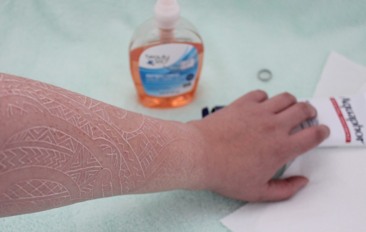 a tattooed arm reaching for aquaphor
