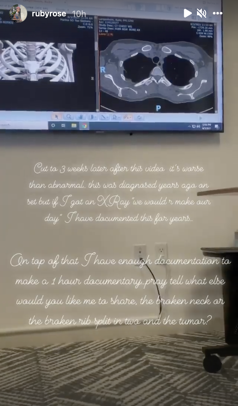 5 Screenshot of Ruby Rose's Instagram Live in cursive font as Rose describes their reasons for leaving Batwoman (full transcript can be found at: https://www.cbr.com/batwoman-ruby-rose-horrifying-set-conditions-slams-wbtv-berlanti/)