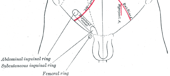 A line drawing shows the pelvic area of a body. To the left of the genital area, there is a small tube labeled "inguinal canal." Other labels include the "femoral ring," the "subcutaneous inguinal ring" and the "abdominal inguinal ring."