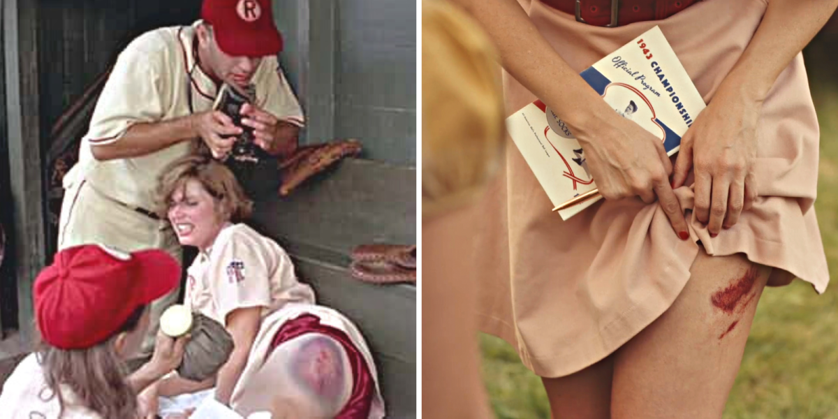 A League of Their Own movie references and Easter eggs: side by side screenshots from the movie and tv show depicting players with large bruises
