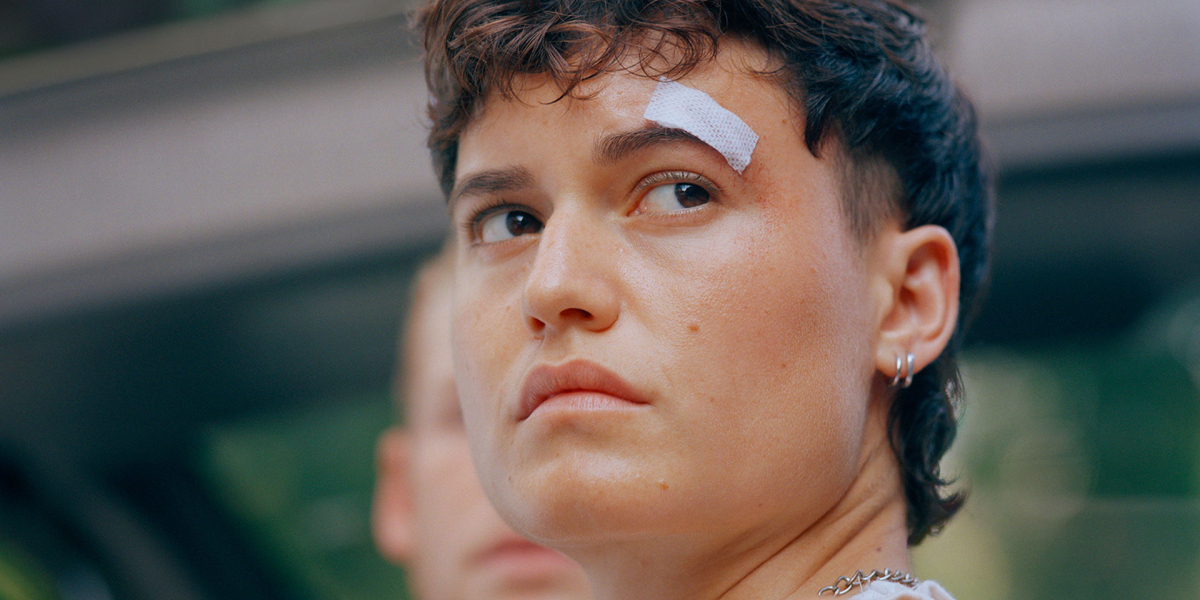 Mutt review: A close up Lio Mehiel with a bandage over their left eyebrow.