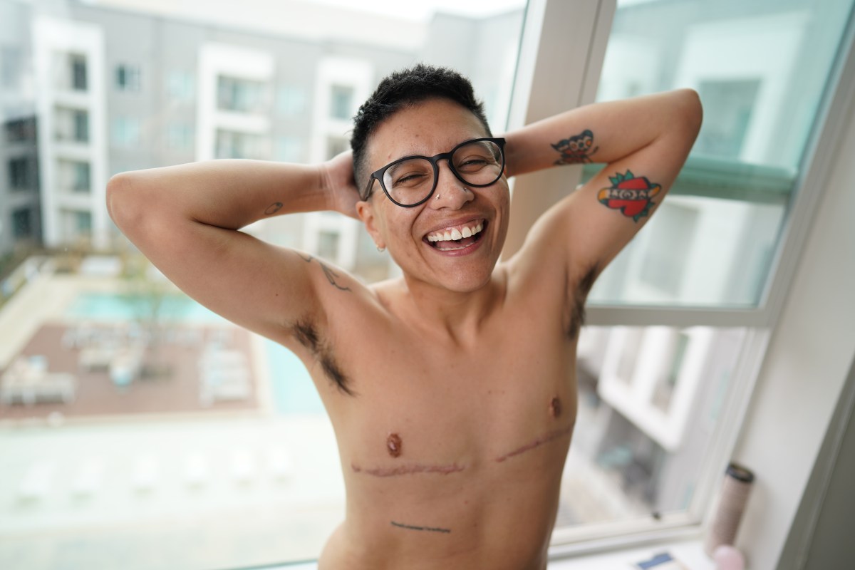 a brown transmasc person with top surgery scars smiles with hands behind head and black framed glasses