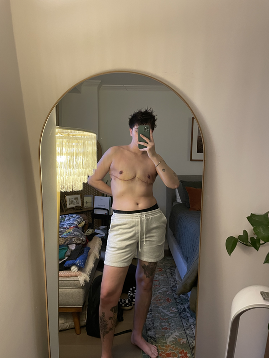 The author Motti shirtless in a mirror pic displaying their top surgery scars