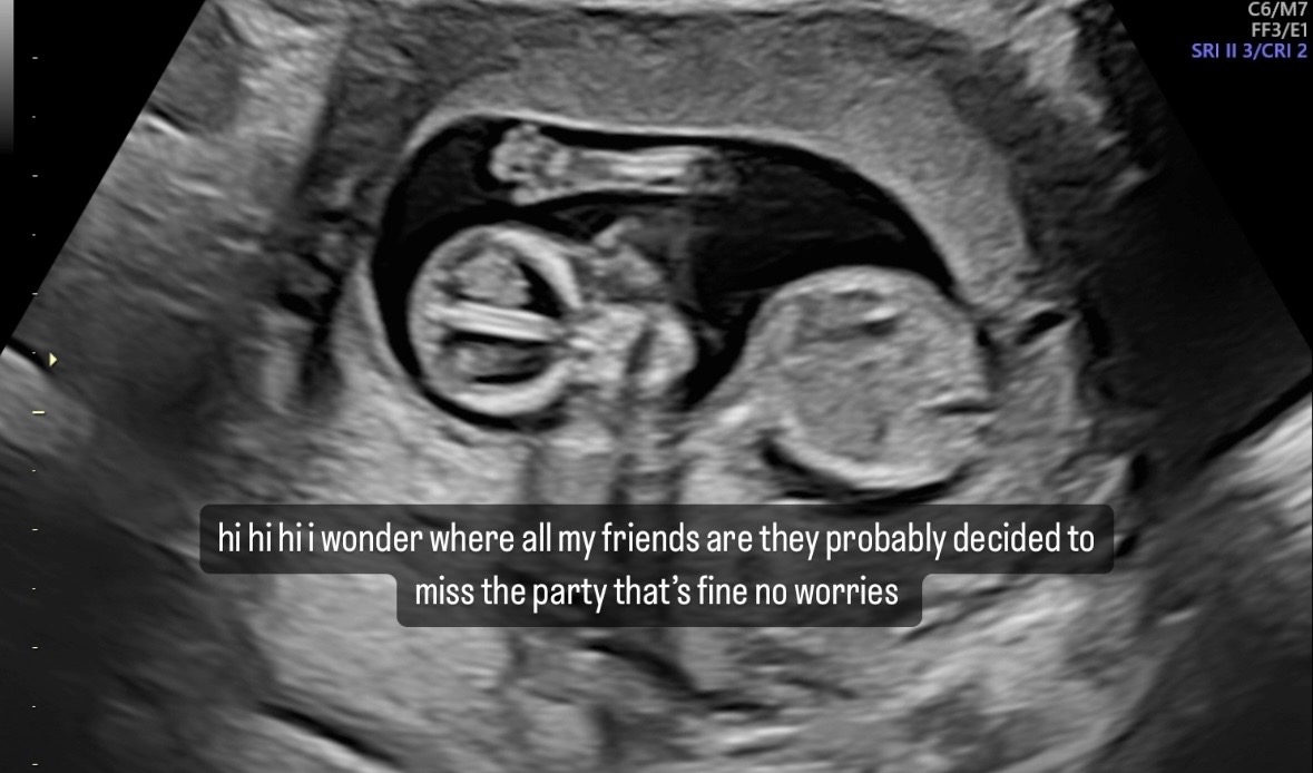 hi hi i wonder where all my friends are they probably decided to miss the party that's fine no worries