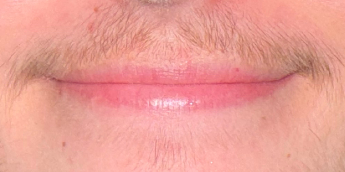 T stache